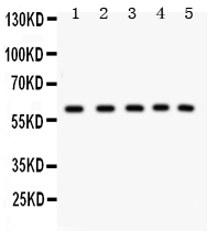 WB - Anti-LKB1 Picoband Antibody ABO11961